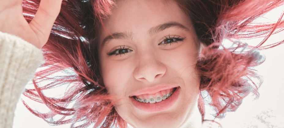 A smiling person with red hair and braces is pictured from below, with hair flowing upwards against a bright, light background.